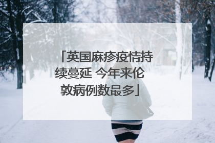 英国麻疹疫情持续蔓延 今年来伦敦病例数最多